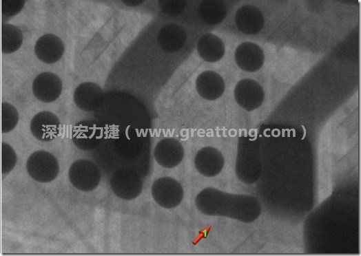 BGA因為焊墊變小，造成錫膏過多而最終形成焊接短路的結(jié)果。